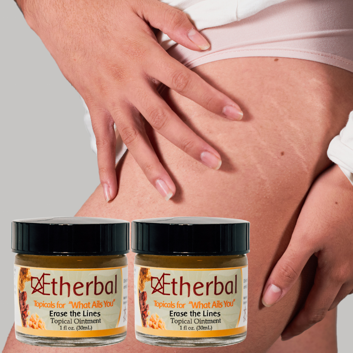 2 Pack Erase the Lines - Smooth Wrinkles and Say Goodbye to Scars and Stretch Marks
