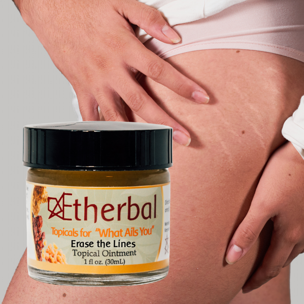 Erase the Lines - Say Goodbye to Scars and Stretch Marks