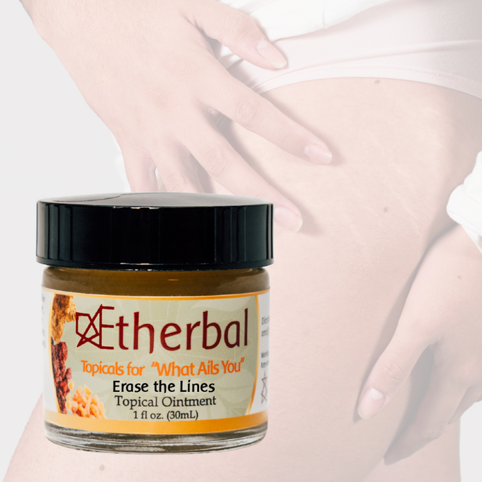 Erase the Lines - Say Goodbye to Scars and Stretch Marks