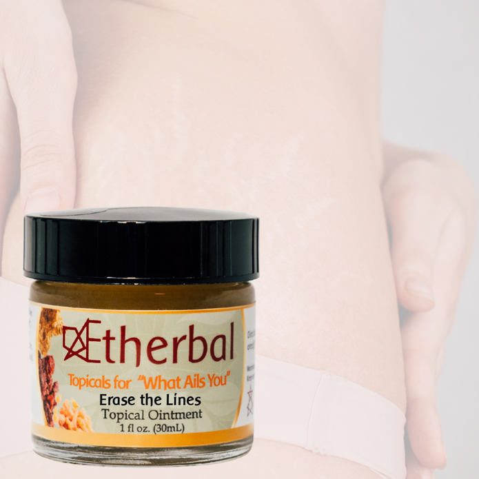 Erase the Lines - Say Goodbye to Scars and Stretch Marks