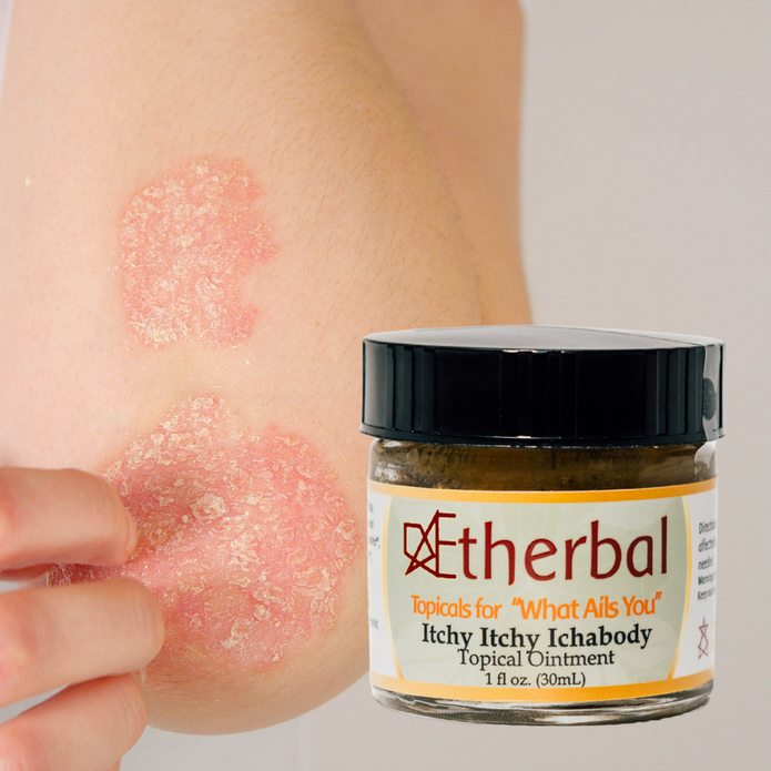 Itchy Ichabody - Soothe Your Skin, Restore it's Health