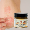 Itchy Ichabody - Soothe Your Skin, Restore it's Health