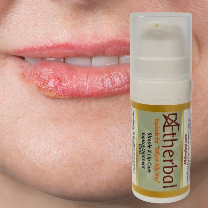 Cold Sore Topical - Simple X Lip Care